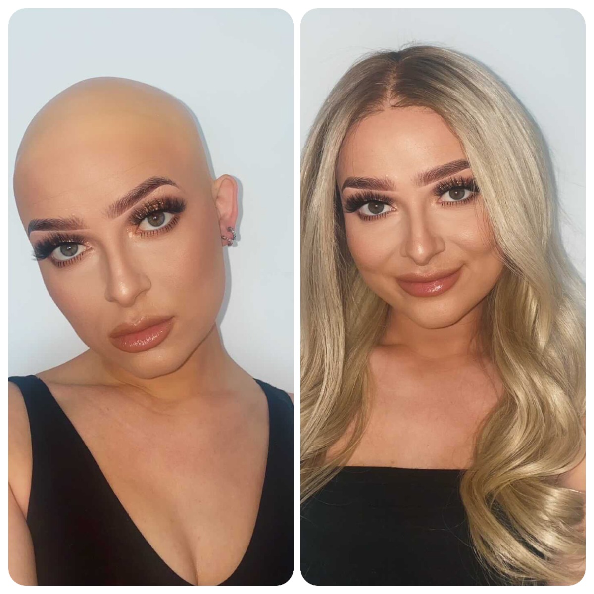 Wigs for alopecia new arrivals